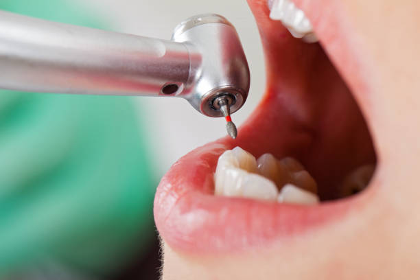 Best Emergency Treatment for Jaw Pain or Injury in Superior, CO